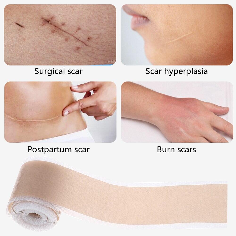 Lisslune | Ultimate Silicone Scar Healing Patch - Revolutionary Treatment for Scars