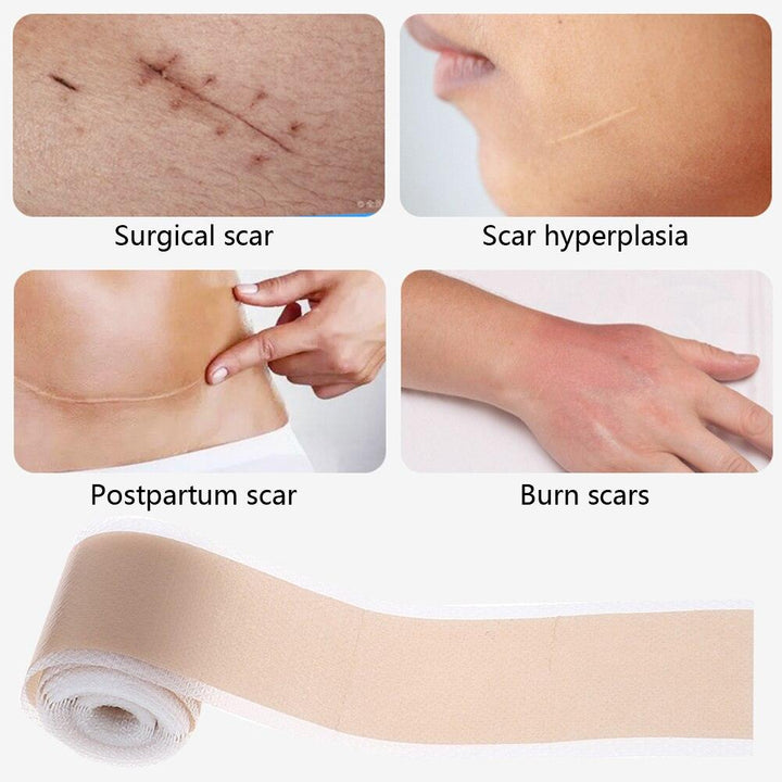 Lisslune | Ultimate Silicone Scar Healing Patch - Revolutionary Treatment for Scars