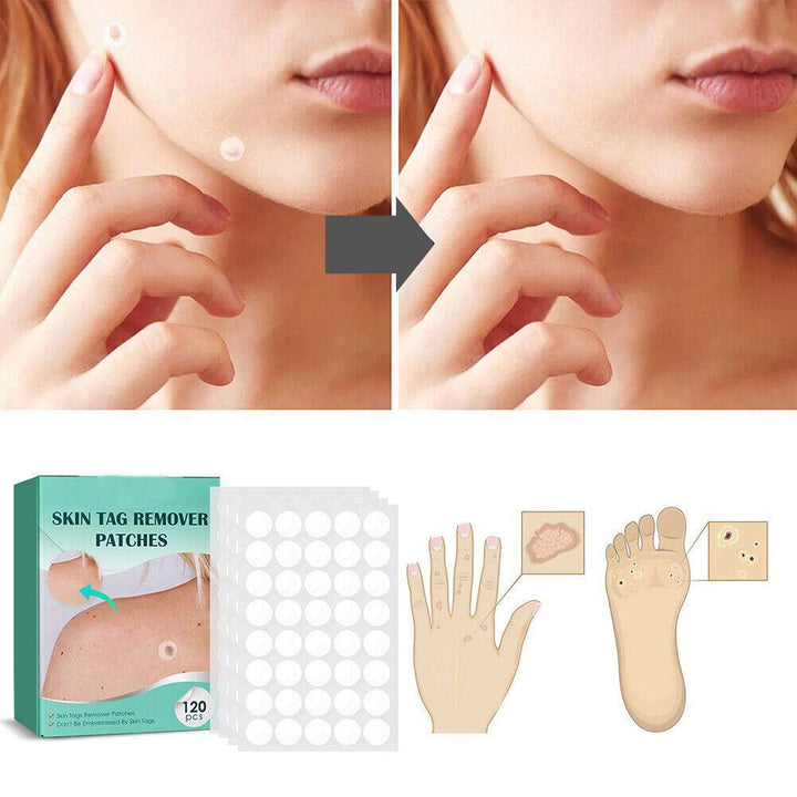 Lisslune | SkinClear - Plaster for the removal of spots and warts