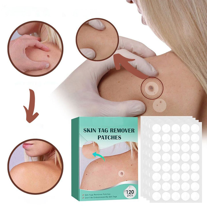 Lisslune | SkinClear - Plaster for the removal of spots and warts