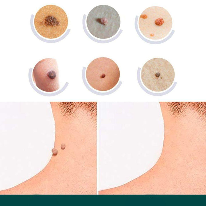 Lisslune | SkinClear - Plaster for the removal of spots and warts
