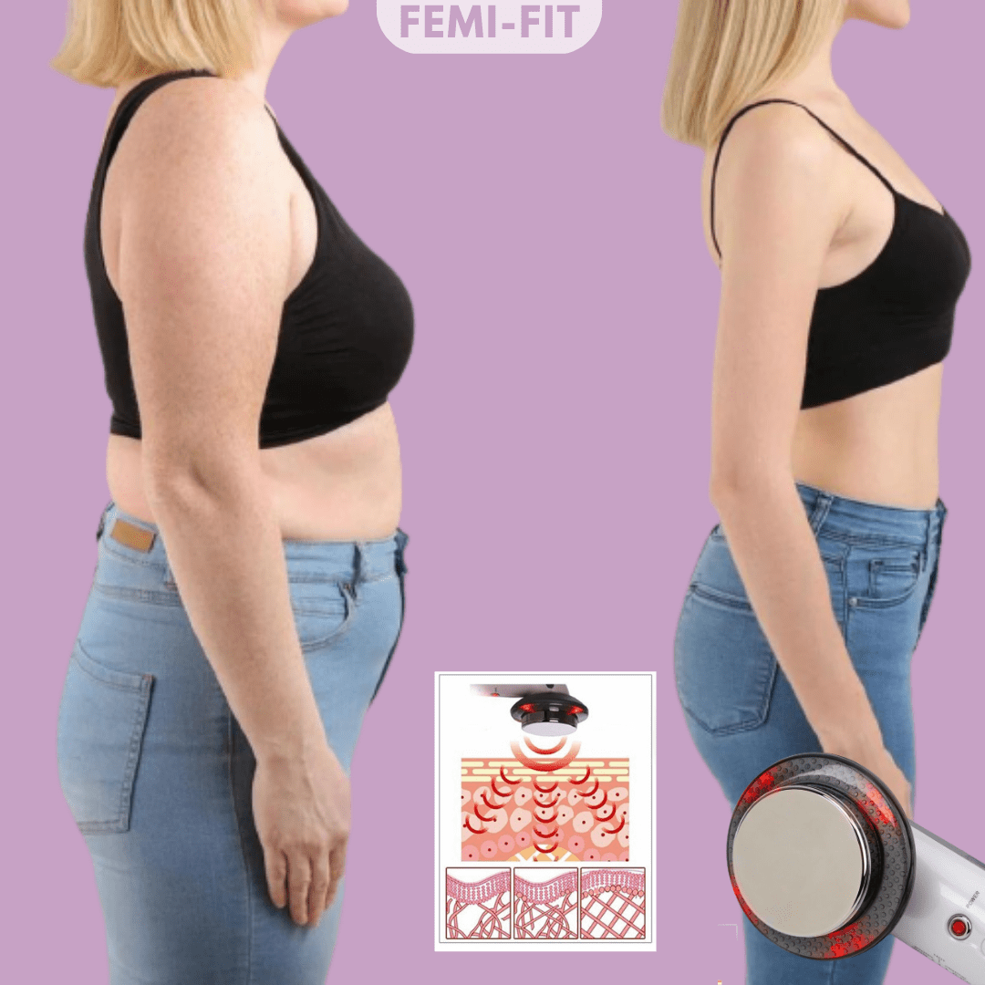 Lisslune | SlimShape – 3-in-1 Cellulite & Fat Burner with EMS, Ultrasound & Infrared Light