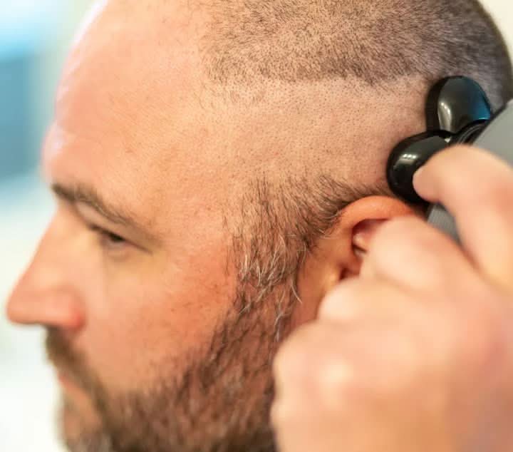 Lisslune | SmoothTrim – 5-in-1 razor with flexible shaving head & accessories