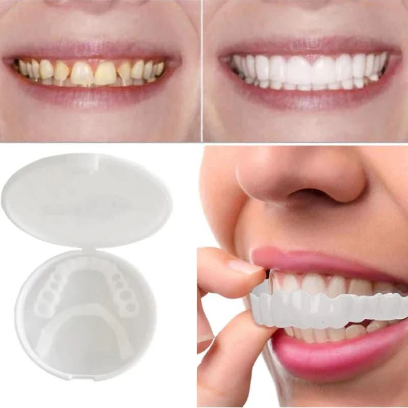 Lisslune | Dental restoration for a bright white smile without a dentist