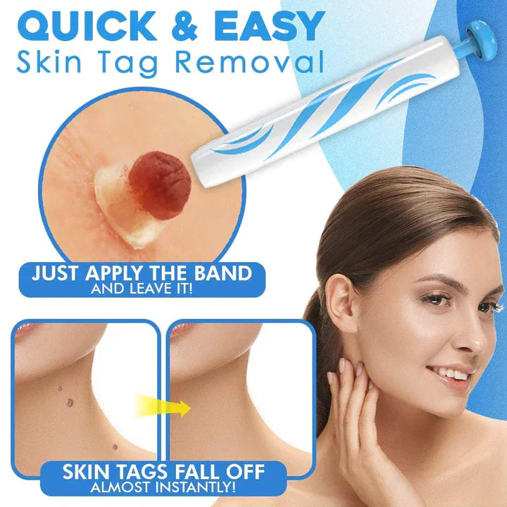 Lisslune | Quick Removal Kit
