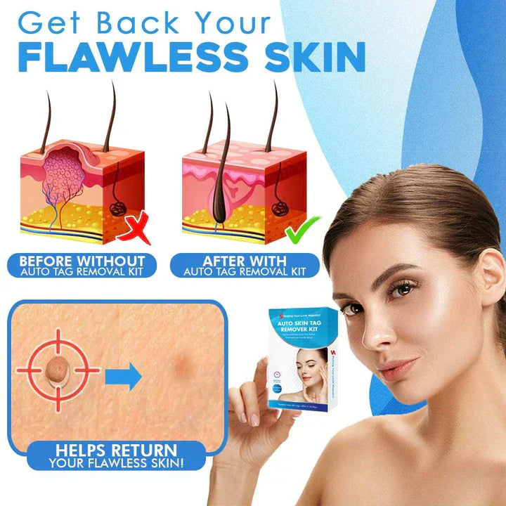 Lisslune | Quick Removal Kit