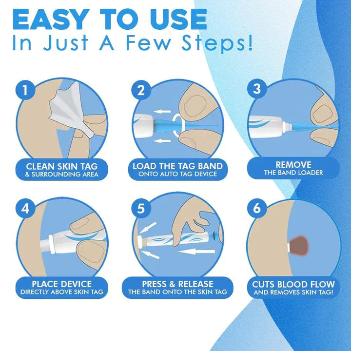 Lisslune | Quick Removal Kit