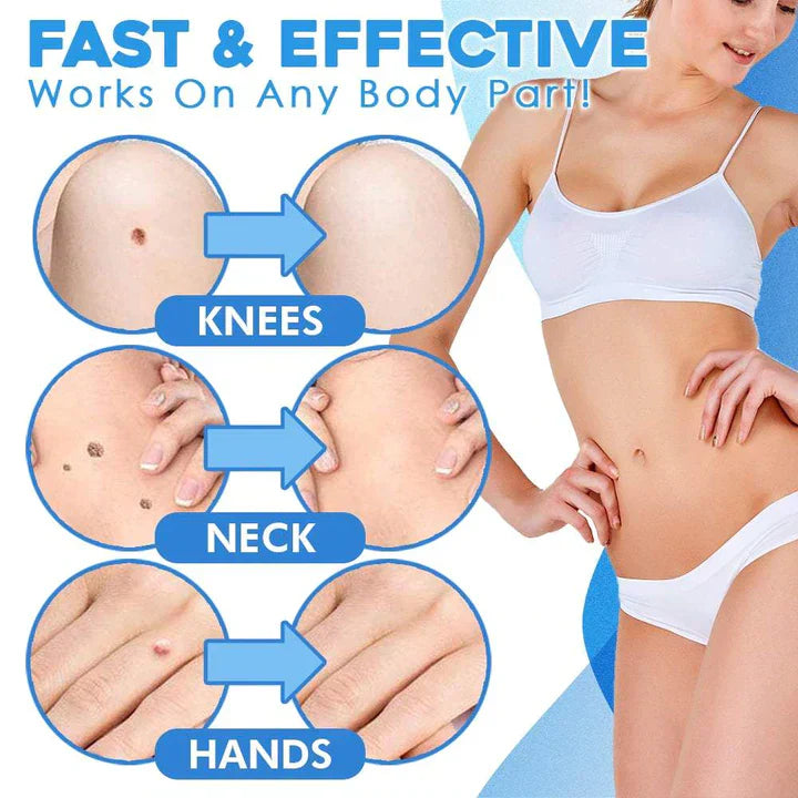 Lisslune | Quick Removal Kit