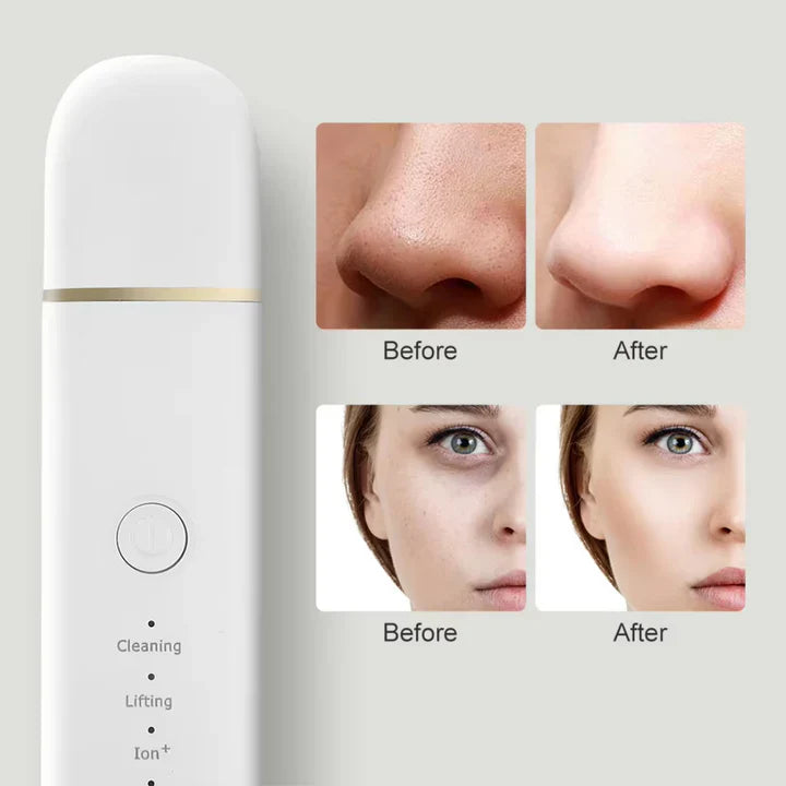 Lisslune | Skin scrubber for deep cleansing