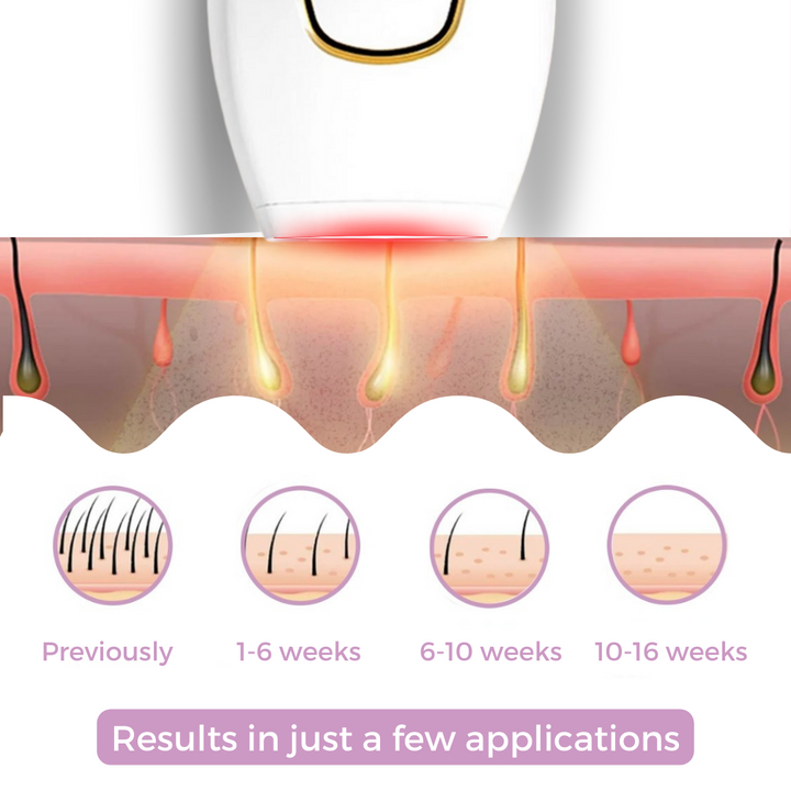 Lisslune | SoftLight IPL Hair Removal Device – Pain-Free Home Hair Removal