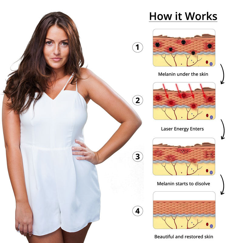 Lisslune | Pulsed Laser Pen with Picosecond Technology
