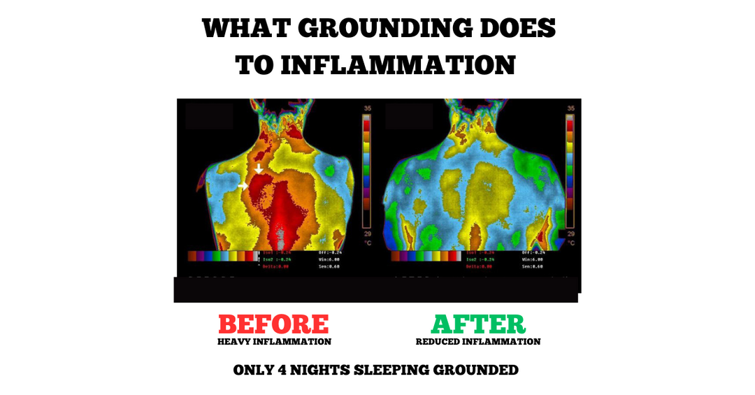 Lisslune | Earthing Grounding Bed Sleep Mat - Earthing Under Sheet Pad for Enhanced Sleep Quality Grounding Well Therapy