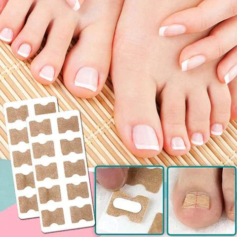 Lisslune | ALIGNSTRIP – Painless Nail Correction Strips for Ingrown & Deformed Nails