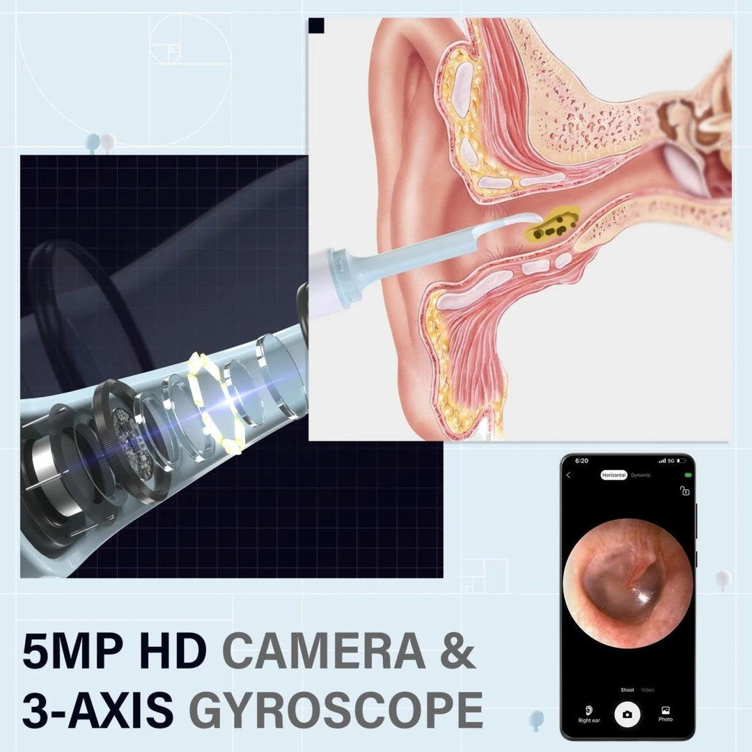 Lisslune | AURIVIEW – Smart Ear Cleaner with HD Camera