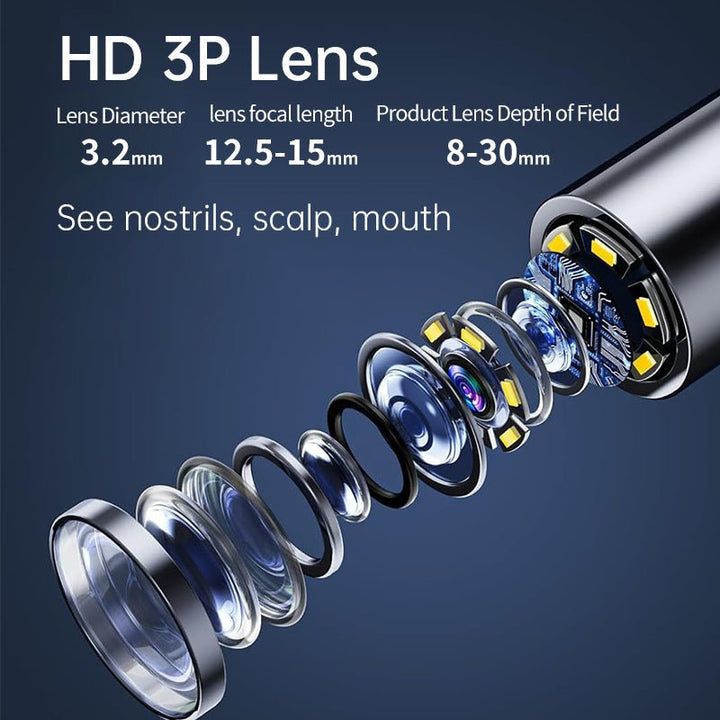 Lisslune | AURIVIEW – Smart Ear Cleaner with HD Camera