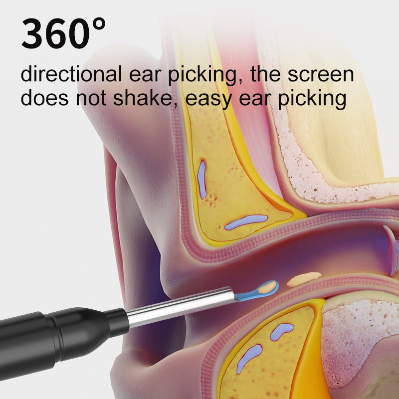 Lisslune | AURIVIEW – Smart Ear Cleaner with HD Camera