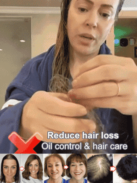 Lisslune | Explosive Ginger Phytochemical Shampoo for Hair Loss Control