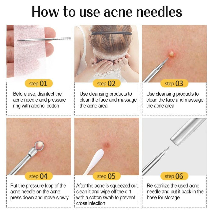 Lisslune | Blackhead and Acne Remover Skin Tools
