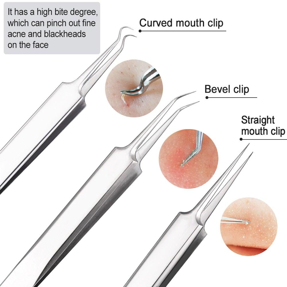 Lisslune | Blackhead and Acne Remover Skin Tools