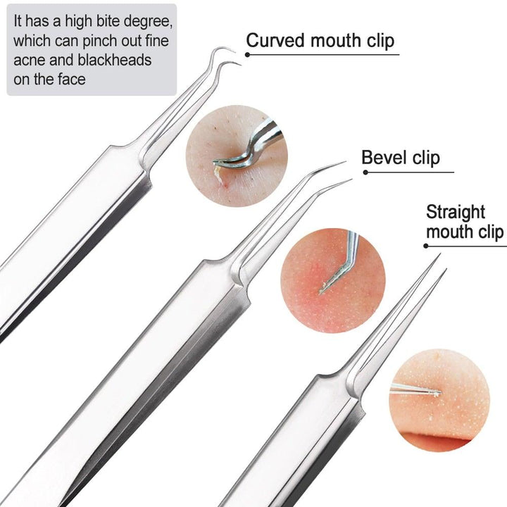 Lisslune | Blackhead and Acne Remover Skin Tools