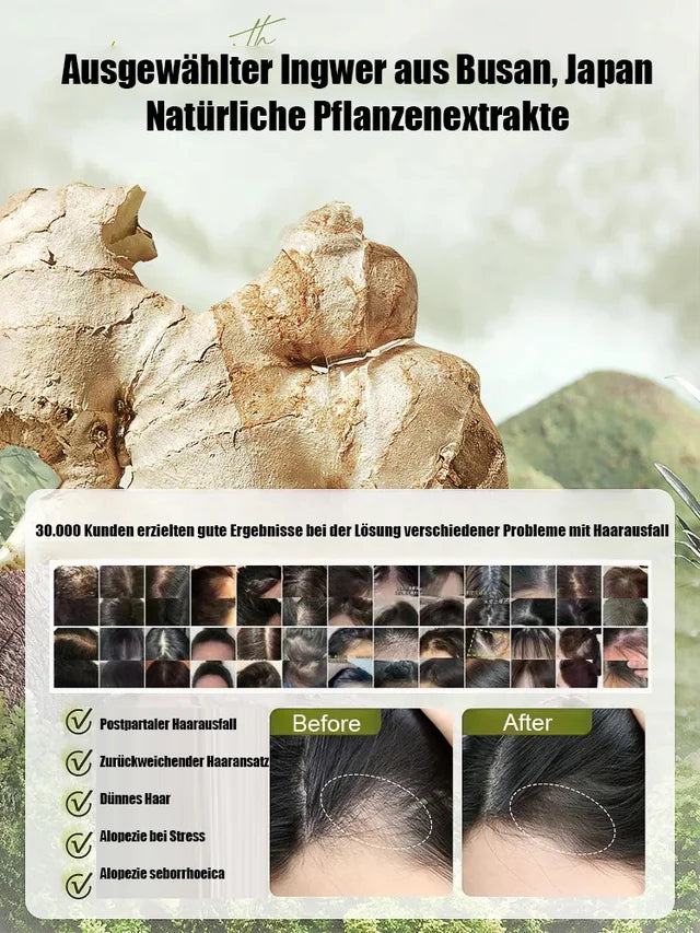 Lisslune | Explosive Ginger Phytochemical Shampoo for Hair Loss Control