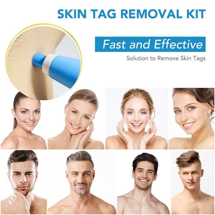 Lisslune | EPICLEAR – At-Home Skin Tag & Wart Remover Kit