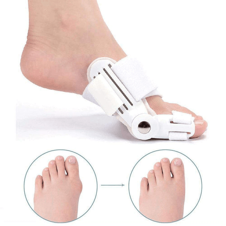 Lisslune | Hallux Valgus Corrective Splint – Adjustable Orthotic for Bunion Relief