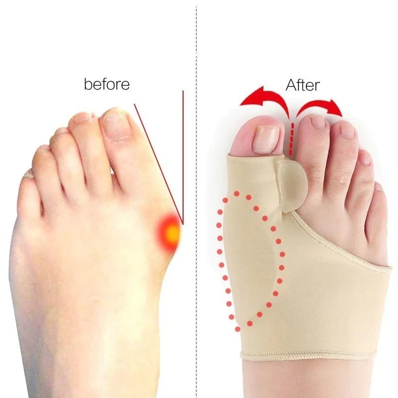 Lisslune | Toe Separator with Alignment Support