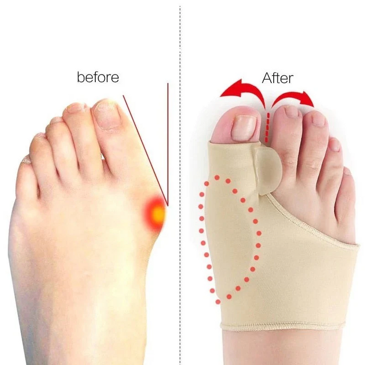 Lisslune | Toe Separator with Alignment Support