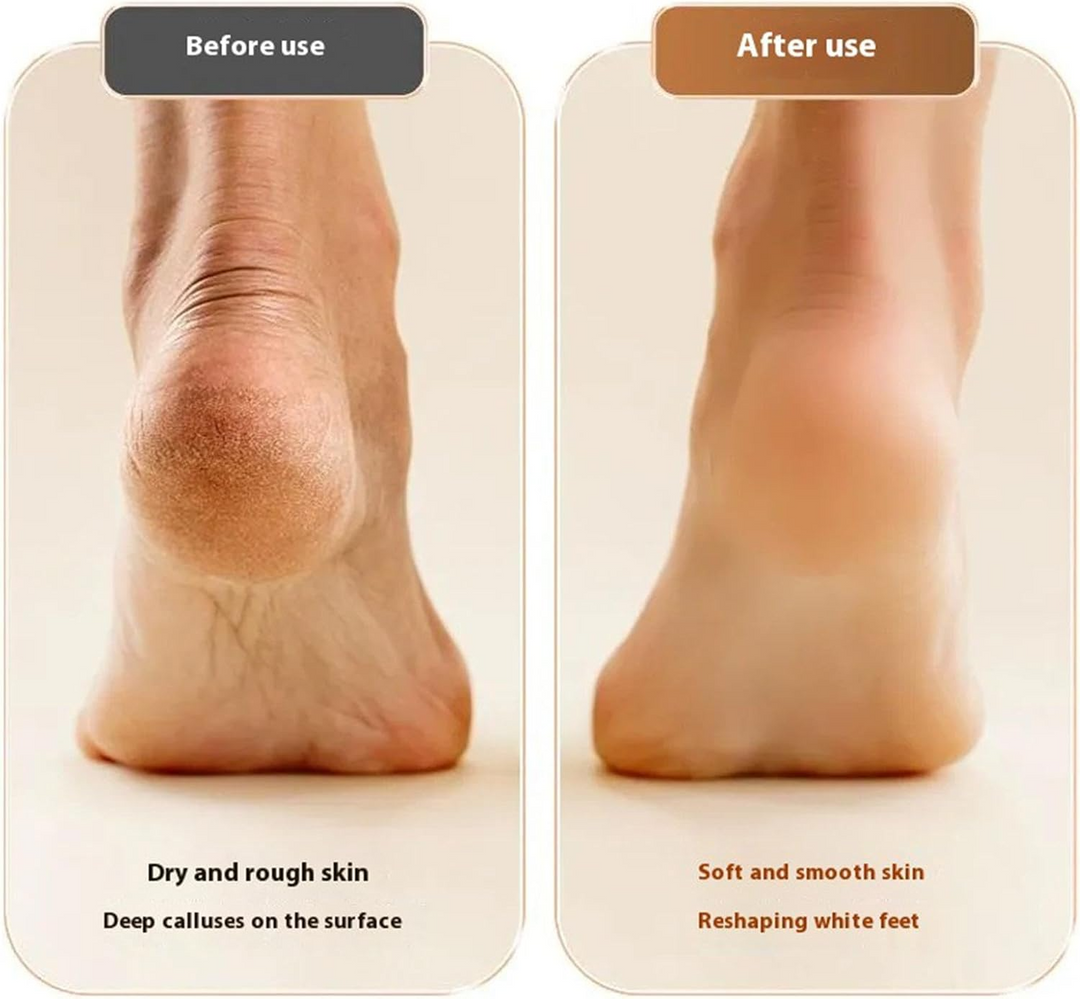 Lisslune | Electric Foot Care Smooth Feet at Home
