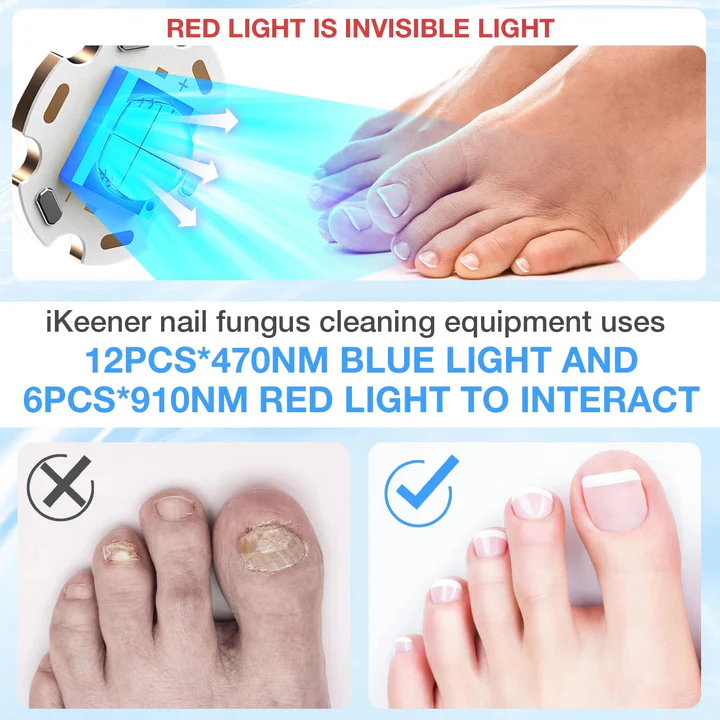 Lisslune | Nail Fungus Laser