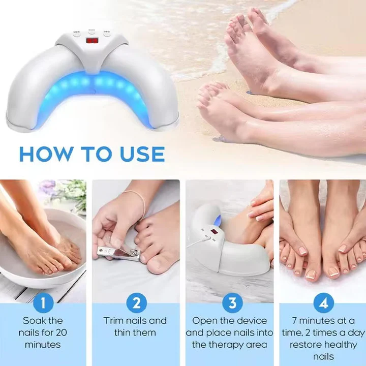 Lisslune | Nail Fungus Laser