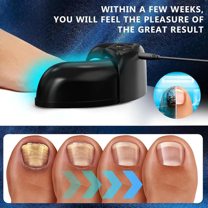 Lisslune | Nail Fungus Laser