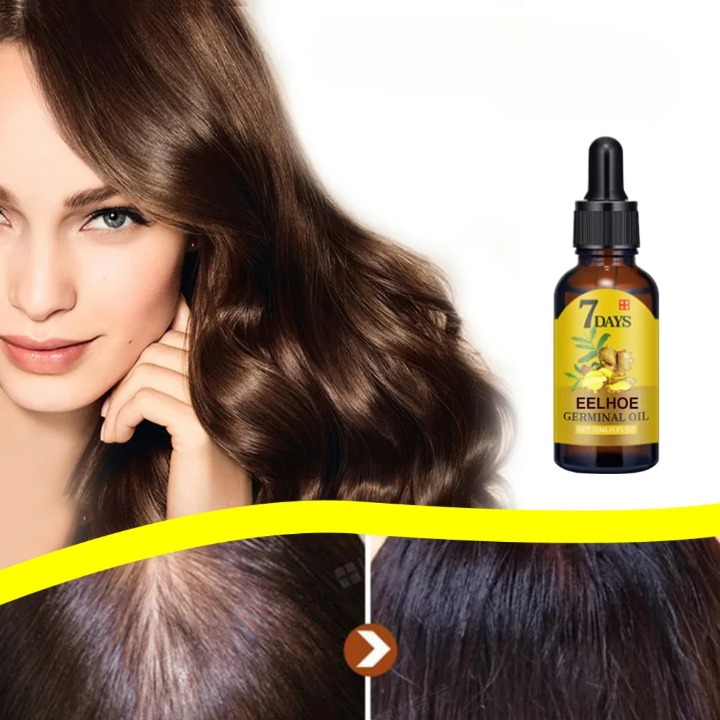 Lisslune | Ginger Hair Growth Natural Treatment Against Hair Loss
