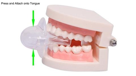 Lisslune | Apnea Tongue Stabilizing Device