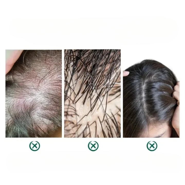 Lisslune | Essential Hair Oil Vegan Lavender Repairs Damaged Hair