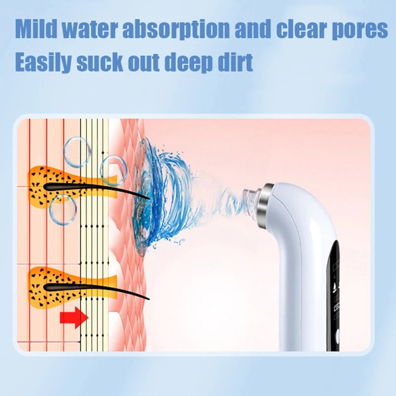 Lisslune | Professional Nose Blackhead Remover Vacuum - Deep Cleansing with Suction Technology