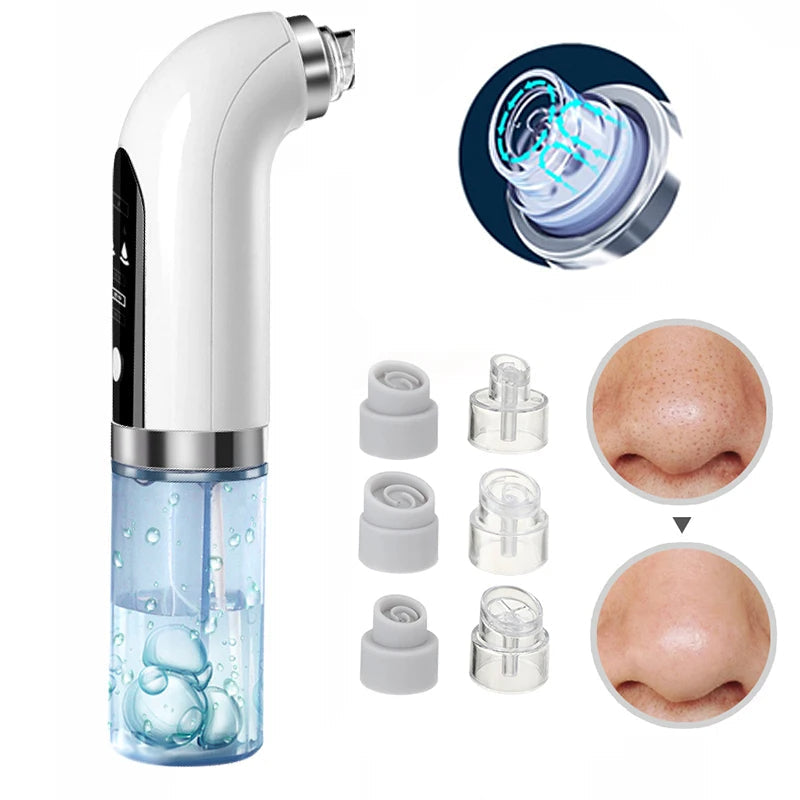 Lisslune | Professional Nose Blackhead Remover Vacuum - Deep Cleansing with Suction Technology