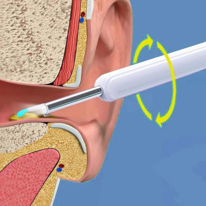 Lisslune | EarScope Pro Ear Wax Removal Kit | High-Resolution Camera & LED Lights for Safe Home Use