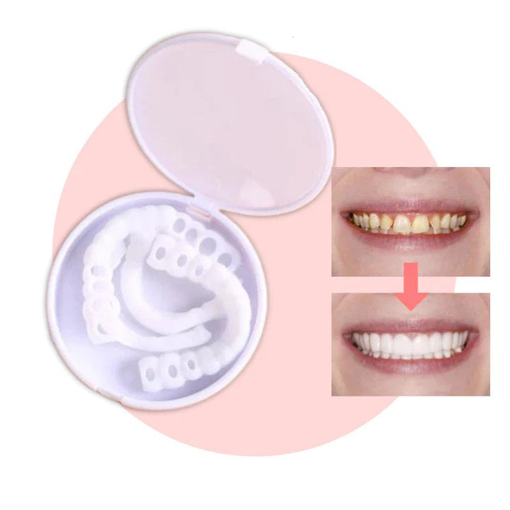 Lisslune | SmileSnap - Always the perfect smile with these veneers