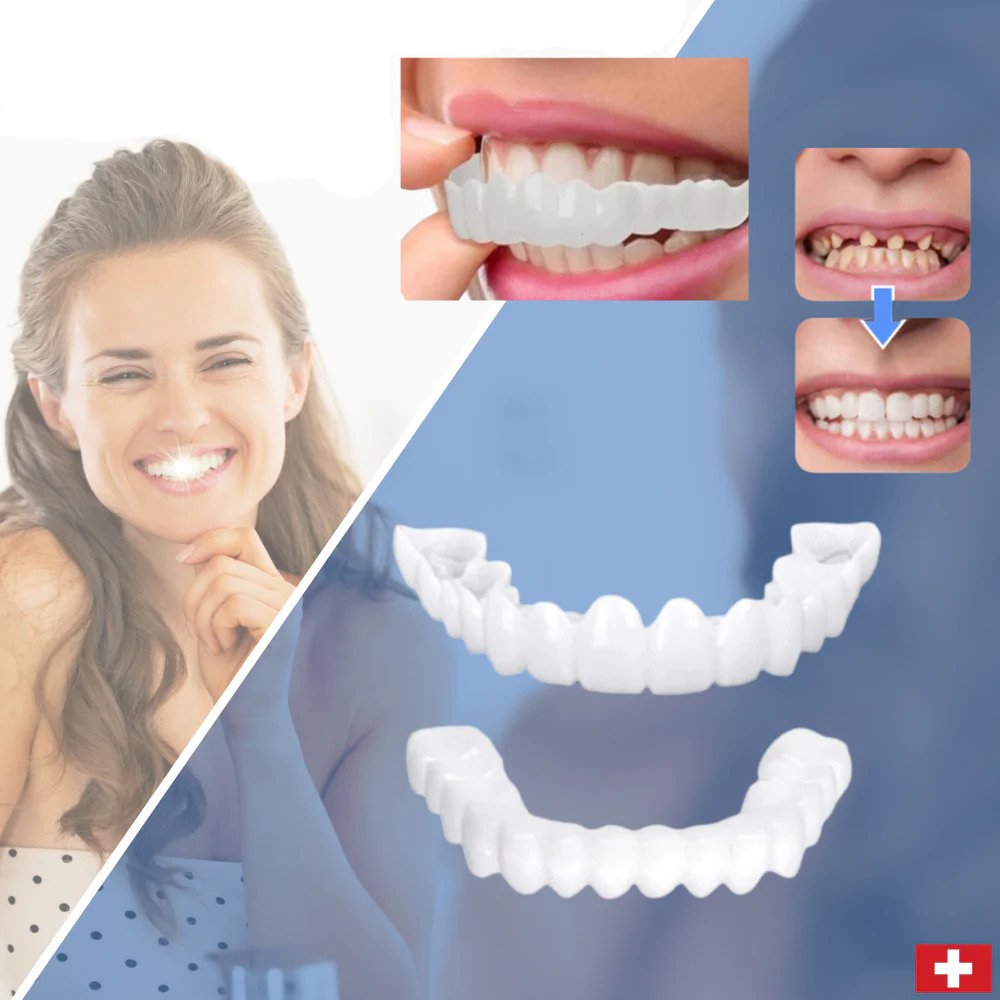Lisslune | SmileSnap - Always the perfect smile with these veneers