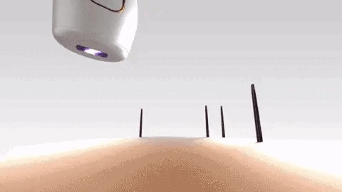 Lisslune | Royal IPL | Permanent Hair Removal