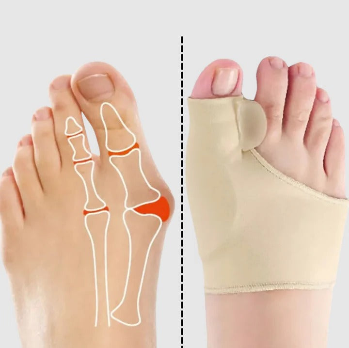 Lisslune | Gel bunion corrector