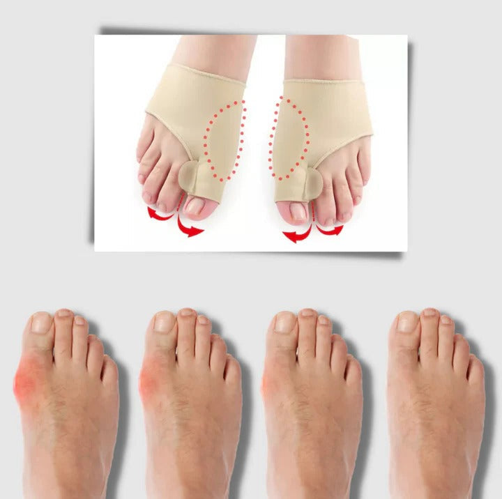 Lisslune | Gel bunion corrector