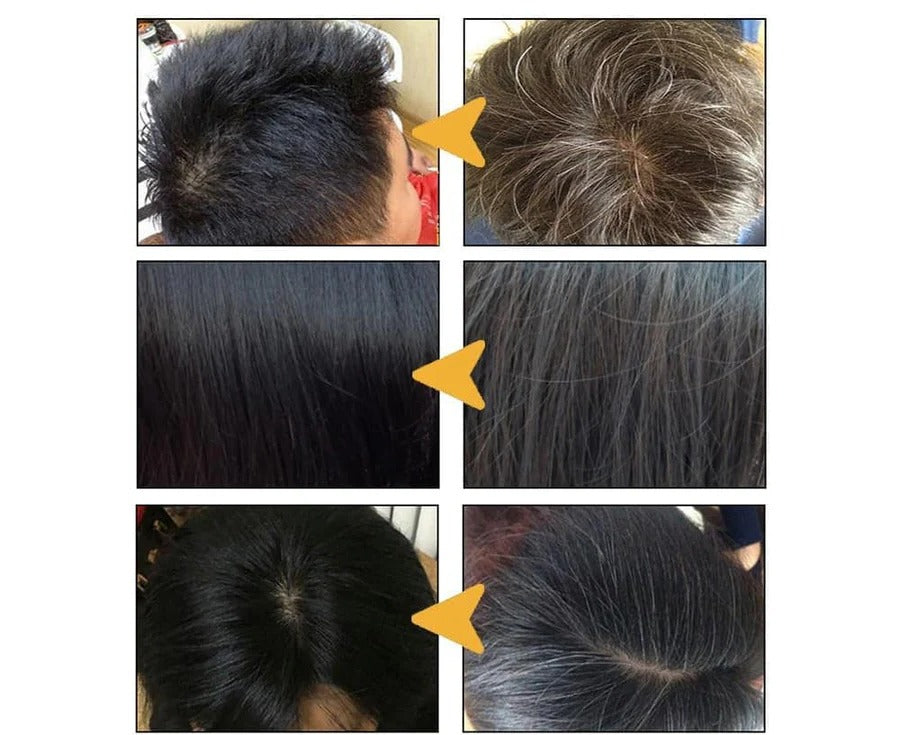 Lisslune | Anti Gray Hair Shampoo Treatment