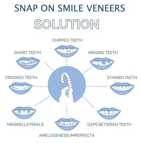 Lisslune | Removable Smile Veneers for Upper and Lower Teeth