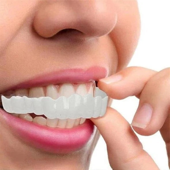 Lisslune | Removable Smile Veneers for Upper and Lower Teeth