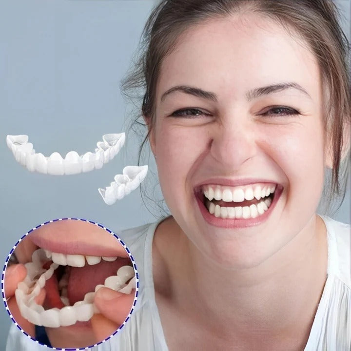 Lisslune | Removable Smile Veneers for Upper and Lower Teeth