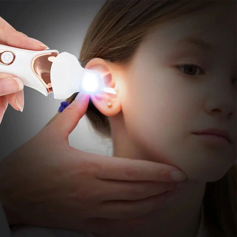Lisslune | 5 in 1 Electric Earwax Remover