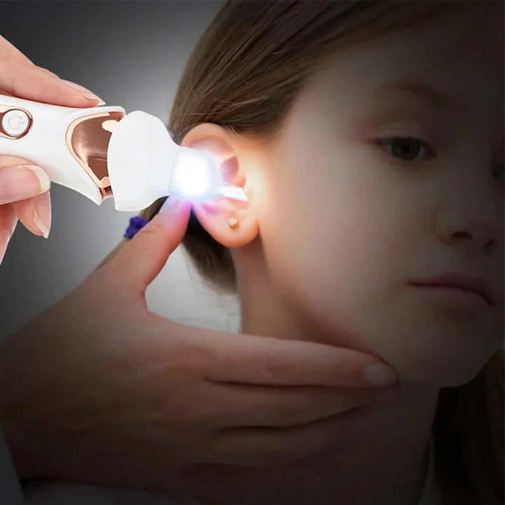 Lisslune | 5 in 1 Electric Earwax Remover